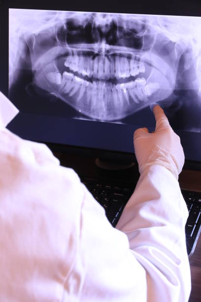 Best Emergency Wisdom Tooth Extraction in Fairview Shores, FL